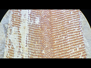 Bryozoa
